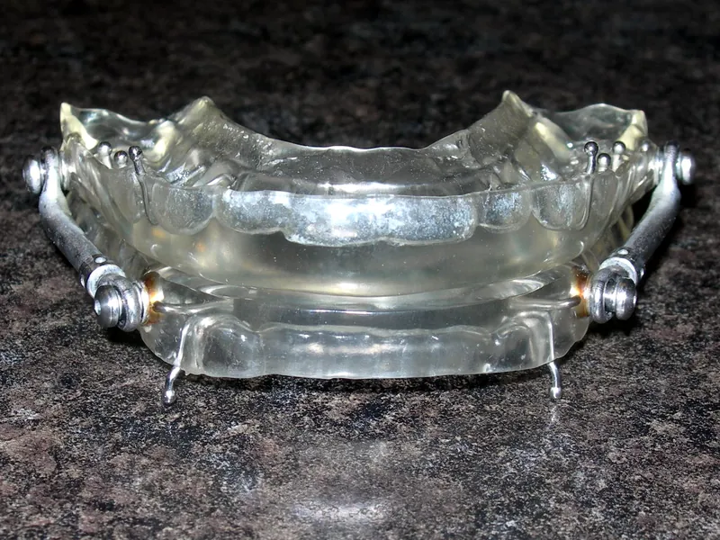 Front view of a custom oral appliance for snoring and sleep apnea