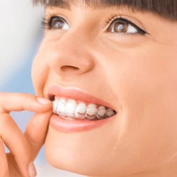 Smiling teen putting in her clear Invisalign aligner